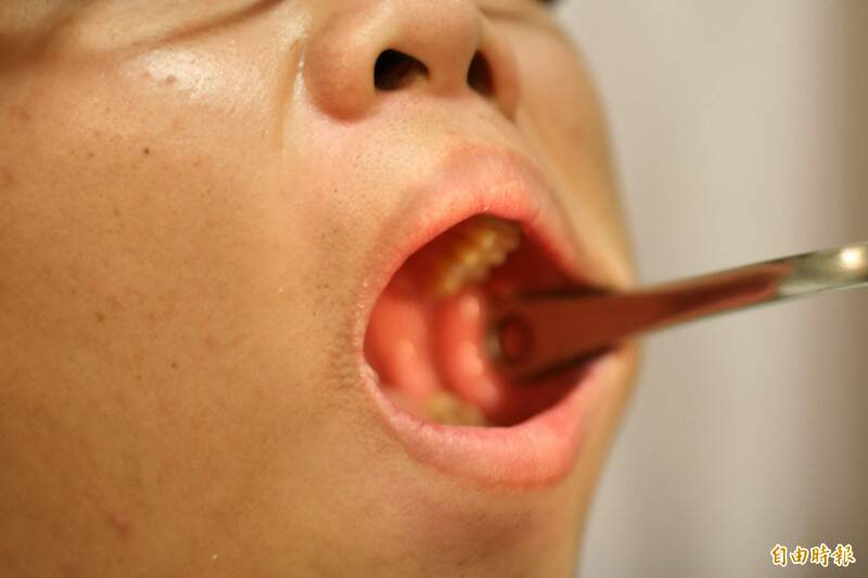 สี่คน มีหนึ่งคนมีกลิ่นปาก! หมอเผย 3 ตัวการลับที่ไม่ใช่แค่แปรงฟันก็แก้ได้